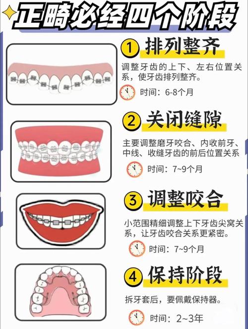 成人畸牙如何矫正_成人矫正牙畸形多少钱_成人矫正牙齿的危害