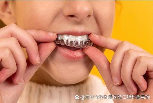 成都6岁孩子地包天矫正到底晚不晚