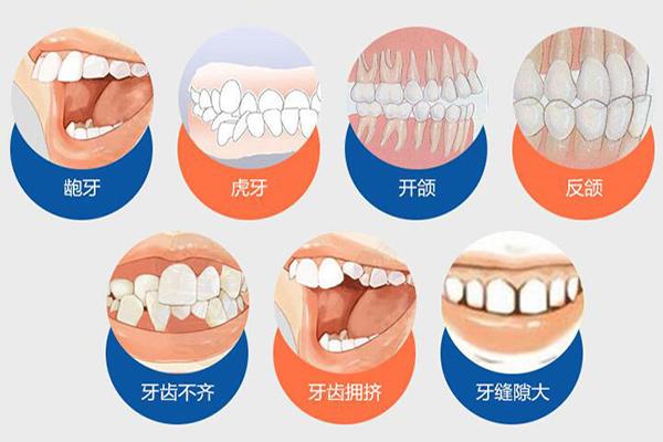成都合肥隐形牙齿矫正费用贵不贵？要多少钱？