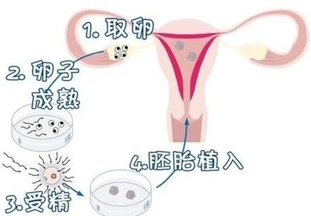 成都无精症试管流程及费用到底怎么算？一篇讲明白