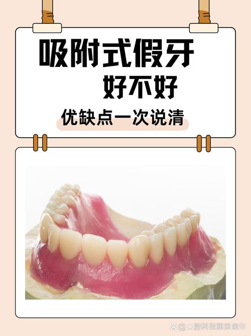 成都缺牙不种牙？活动假牙固定桥吸附性义齿哪个好