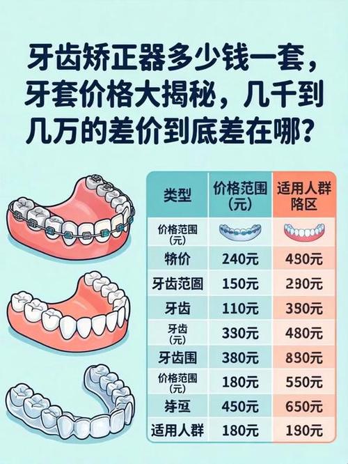 成都7天矫正牙齿要多少钱 过来人告诉你真实价格与风险