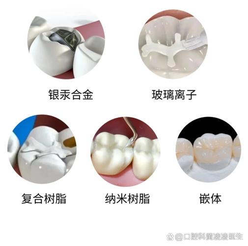 成都补牙用什么材料好？哪种补牙材料最靠谱？