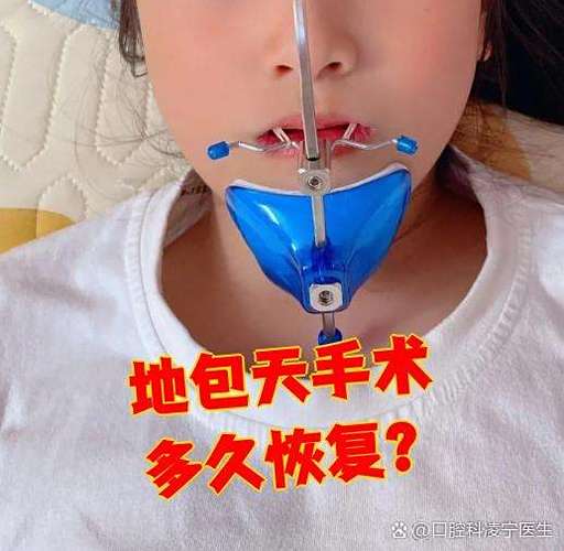 成都正颌手术矫正牙齿靠谱吗，效果能维持多久