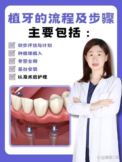 成都登特口腔植牙怎么样 缺牙必看攻略