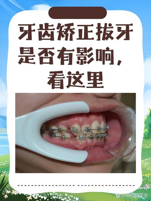 成都哪个医院牙齿矫正比较好 教你避开这3个坑