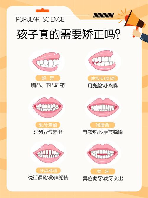 成都宝宝地包天牙齿纠正要趁早