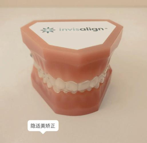 成都深圳牙缝过大矫正多少钱 明细与避坑指南