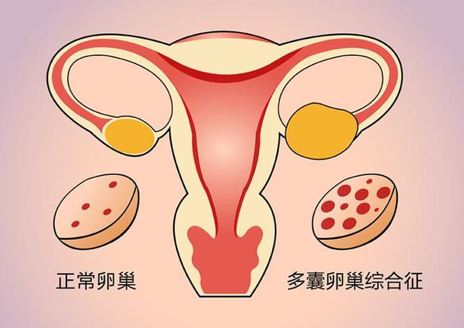 成都三代试管遗传病筛查是什么意思？有家族病史的到底该不该做