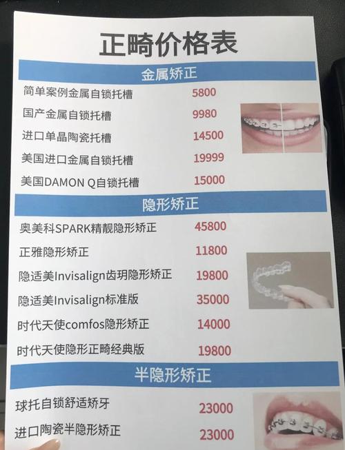 成都30岁做牙齿矫正多少钱 这份费用清单请收好