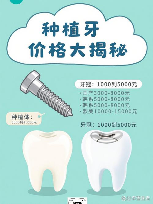 成都奥齿泰种牙多少钱一颗？2026年价格全解析