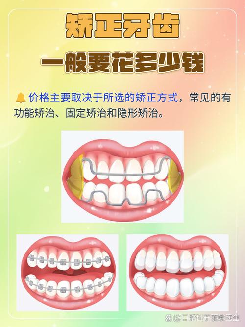 18岁牙齿还能矫正吗多少钱_牙齿矫正能要孩子吗_牙齿矫正可以