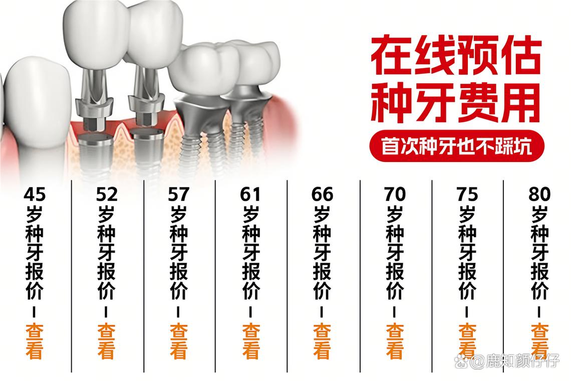 成都深圳罗湖种牙哪家靠谱 诺贝尔种植牙医院怎么选