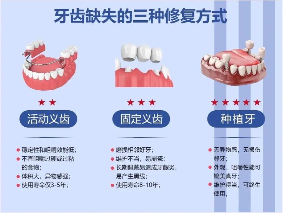成都缺牙不种牙还有哪些靠谱的修复方法
