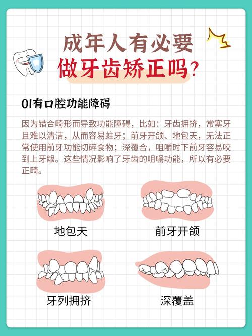 成都21岁矫正牙齿还来得及吗成年人正畸全解答
