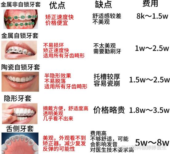 成都25岁做牙齿正畸要花多少钱 成人矫正费用清单