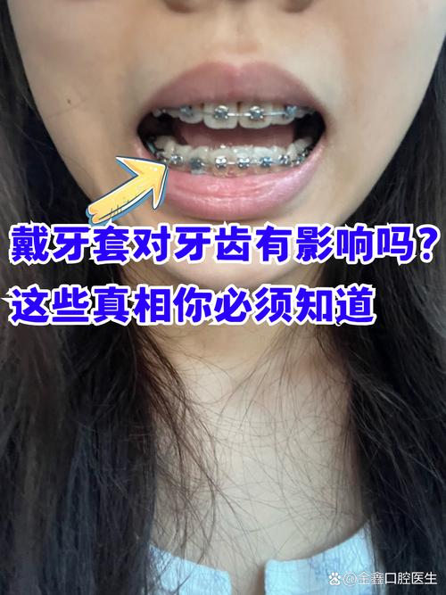 40岁的人可以做牙齿矫正吗_矫正牙齿的时候可以整容吗_牙齿矫正做人可以用医保吗