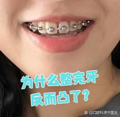 成都牙齿不齐别担心 纠正牙齿的较佳年龄看这里