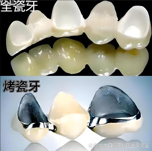 成都天津种一颗牙要多少钱?看完这篇就懂了