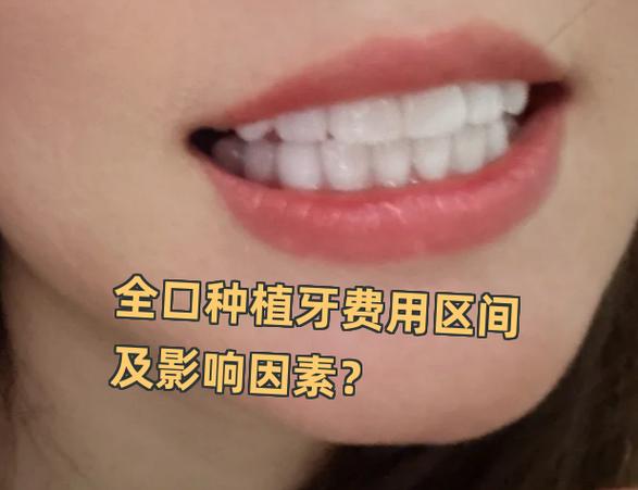 成都深圳罗湖骨量不足全口种牙大概多少钱