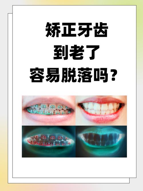 成都43岁矫正牙齿晚不晚 过来人告诉你答案