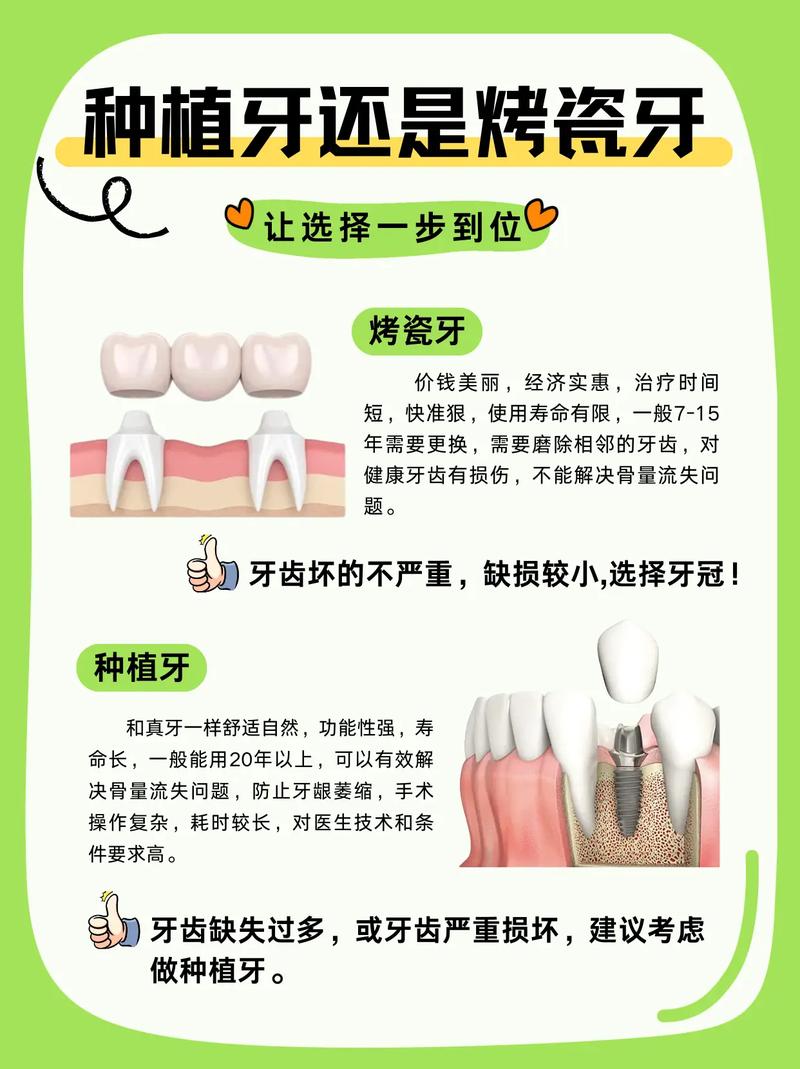 成都烤瓷牙还是种植牙 牙医教你选对修复方式