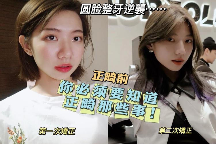 成都23岁整牙还来得及吗？过来人说实话