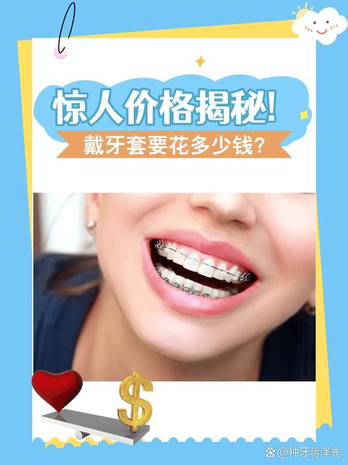成都矫正牙齿透明牙套到底要花多少钱 看完心里有底