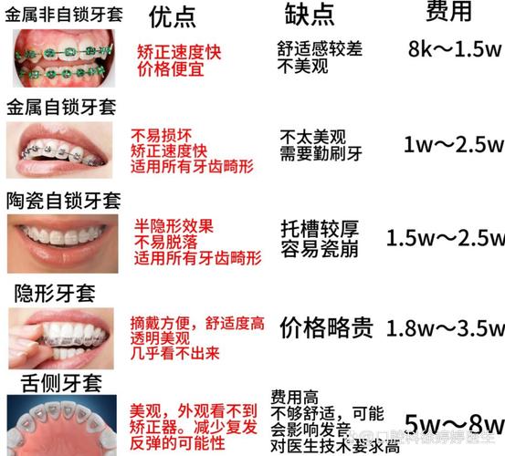 成都深圳福田青少年做钢丝牙套大概要花多少钱?