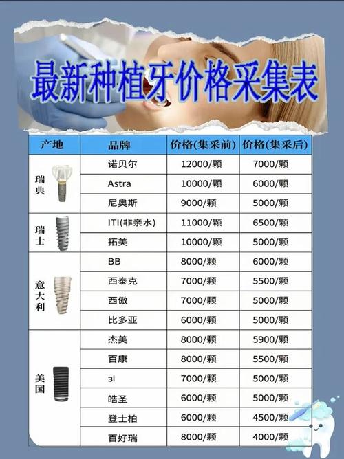 牙种植_牙苗菜的种植方法及视频_成都市种植牙一颗大概多少钱