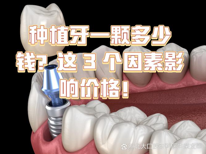 成都镶一颗种牙要多少钱 影响种植牙费用的关键因素梳理