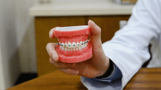 成都深圳蛇口隐形矫正到底多少钱？2026年真实费用大揭秘