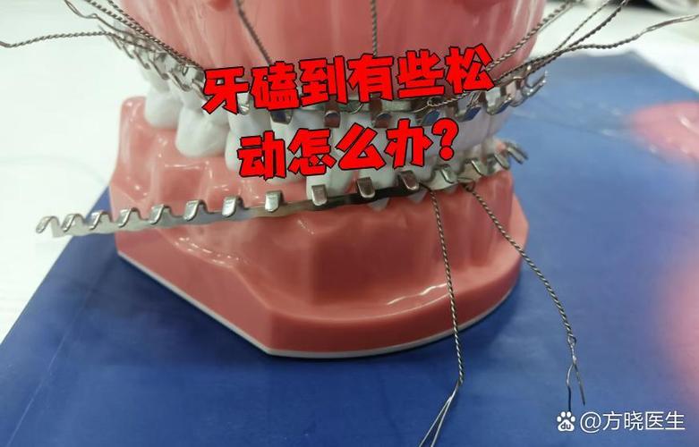 成都孩子牙齿磕碰松动了怎么办？多久能自己长好