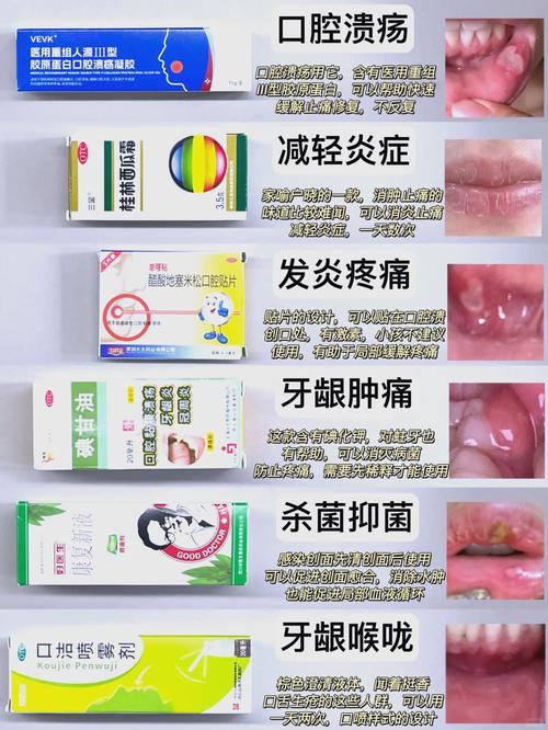 成都小孩口腔溃疡吃什么好的快？收下这份家庭偏方与饮食指南，轻松缓解娃的疼痛