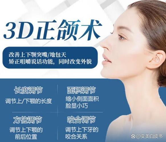 成都骨性地包天矫正花费解析 全面了解骨性地包天矫正具体费用