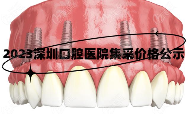 成都深圳种牙集采落地，到底能省多少钱？