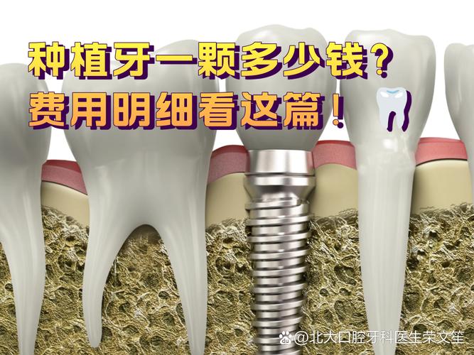 成都西安种牙2026年最新报价：单颗2600到4900元真实情况揭秘