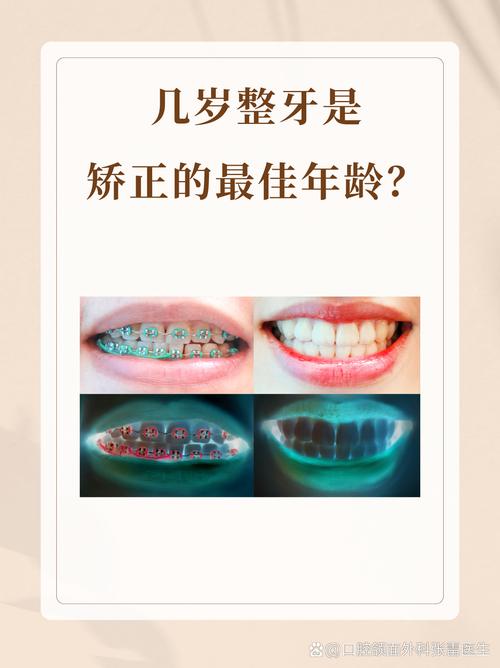 成都60岁能做牙齿矫正吗 医生说实话：年龄不是问题，关键看这几点