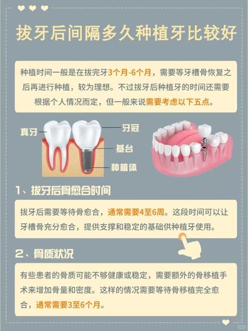 成都拔牙后必须马上种牙吗？等多久最合适