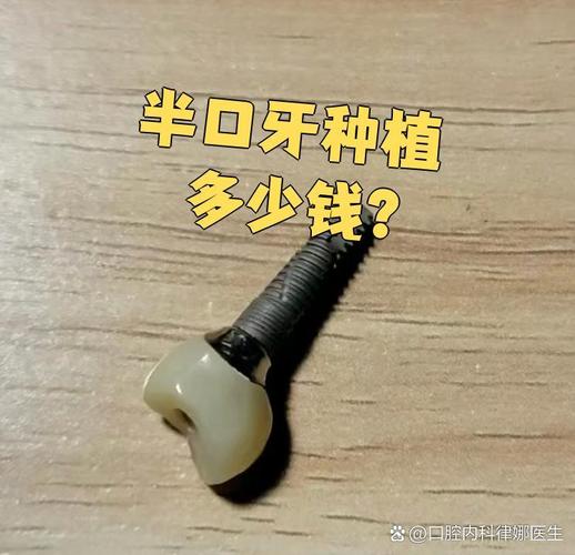 成都深圳宝安半口种牙多少钱 中老年价格详解
