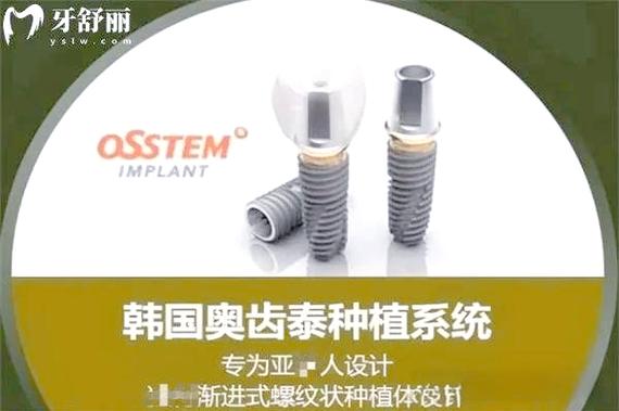 成都深圳奥齿泰种植牙优缺点和价格全解析