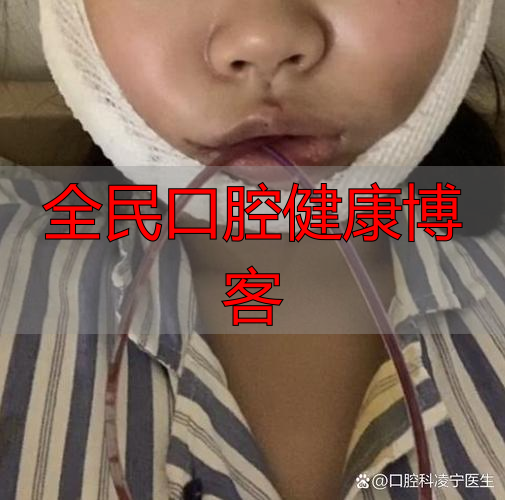 成都口腔颌面部受伤啥特点？不只影响呼吸进食，感染风险也很高