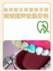 成都自己用超声波洗牙安全吗？洗牙是医疗行为，别自己瞎搞