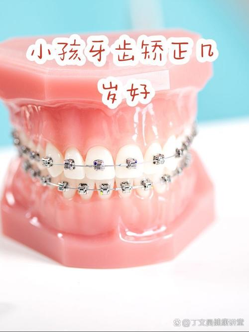 成都16岁牙齿矫正晚吗？医生：抓住黄金期，效果一样好