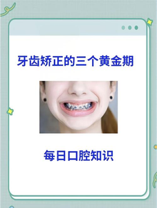 成都16岁矫正牙齿真的晚吗？抓住黄金期的尾巴，效果一样好