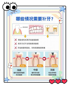 补牙缝费用_补牙会不会越补越坏_补牙补缝