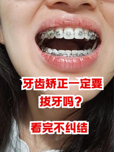牙齿矫正可以医保报销吗_30岁可以矫正牙齿么_牙齿矫正可以只矫正几颗吗