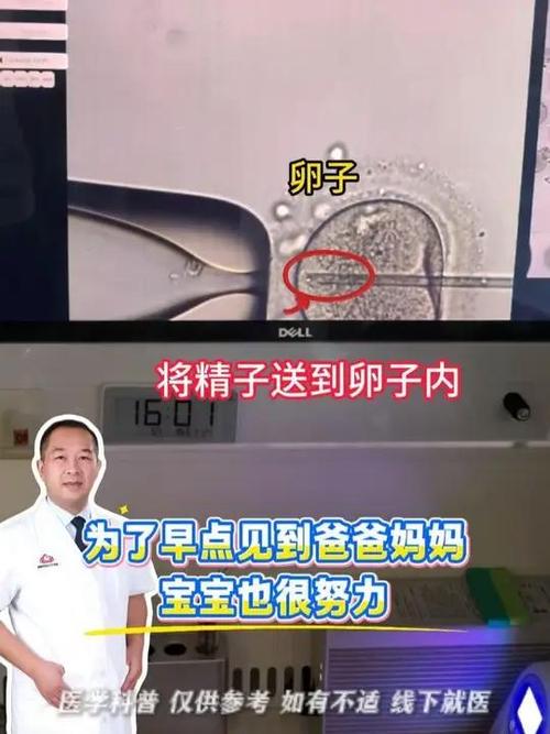 成都二代试管原理详解 卵胞浆内单精子注射如何助孕