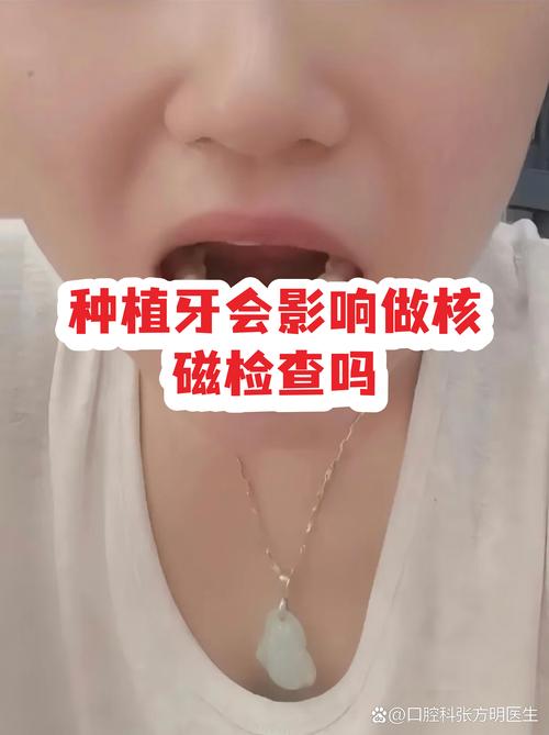 种植牙能做磁共振_口中有种植牙可以做核磁吗?_种植牙能做核磁