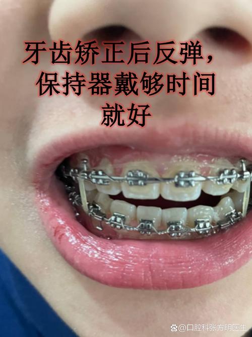 成都40多岁做牙齿矫正，晚不晚？效果好吗？